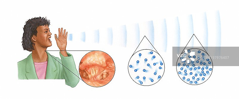 女性呼喊，显示声波以及声带、稀疏和压缩插图图片素材