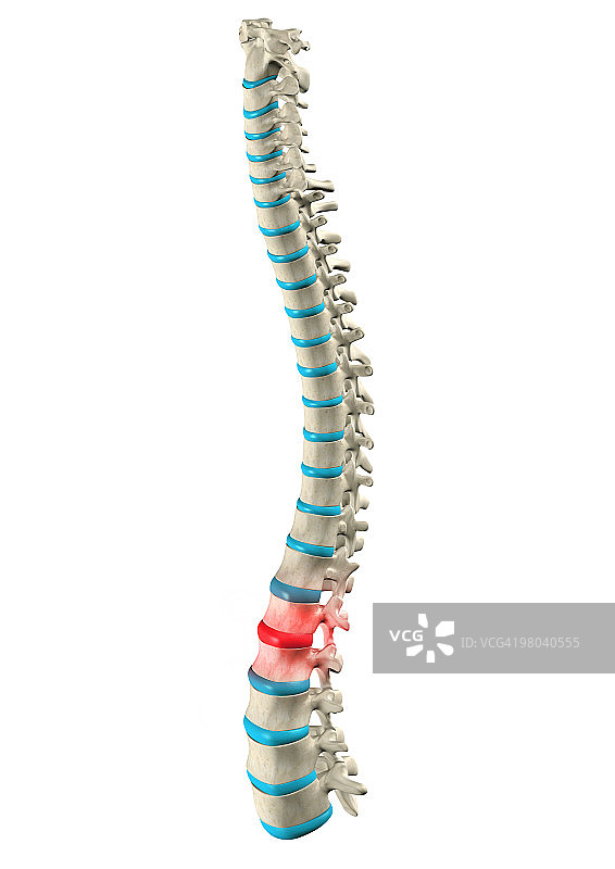 人体脊柱疼痛生物医学图示图片素材