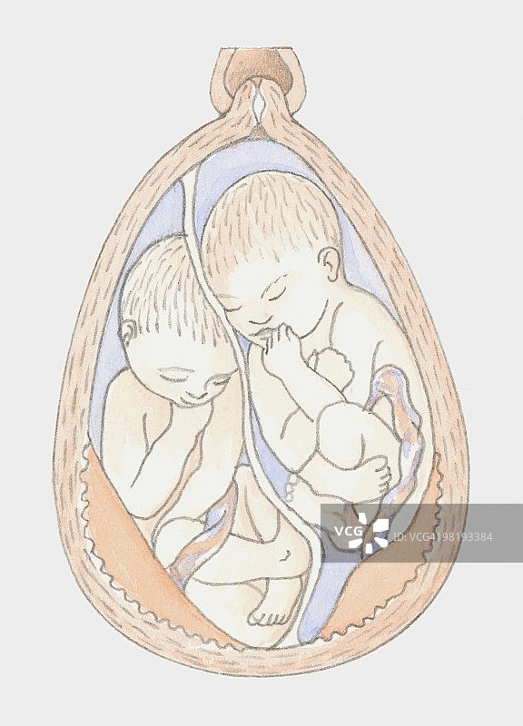 子宫内的异卵双胞胎图片素材