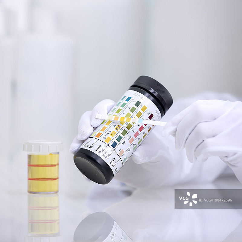 尿液样本测试图片素材