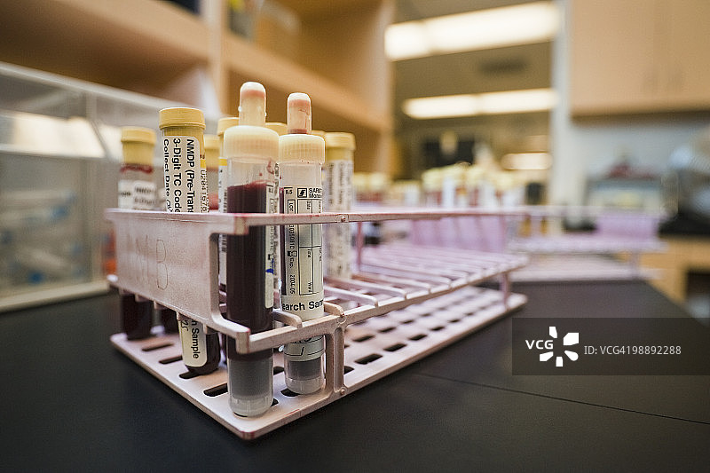 托盘中的血液样本图片素材