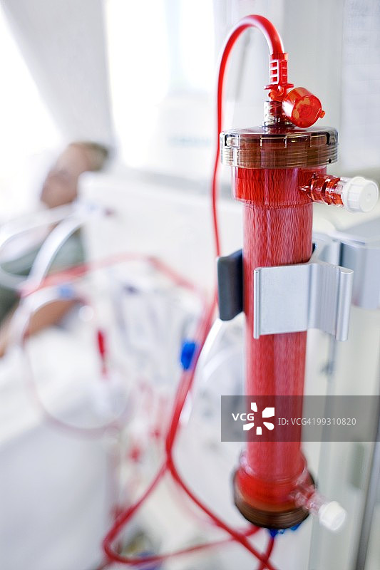 肾透析图片素材