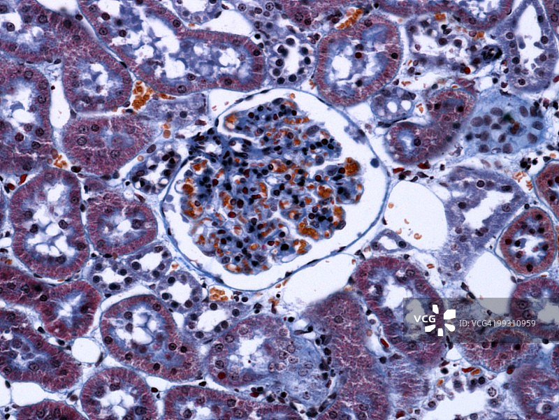 肾小球显微照片图片素材