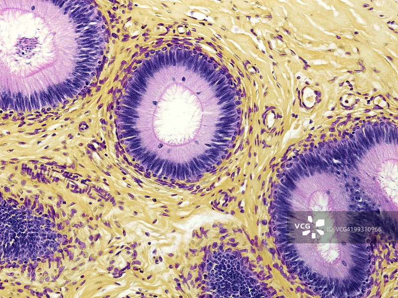 附睾，显微照片图片素材