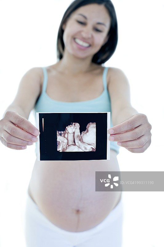孕妇手拿她的婴儿扫描图图片素材