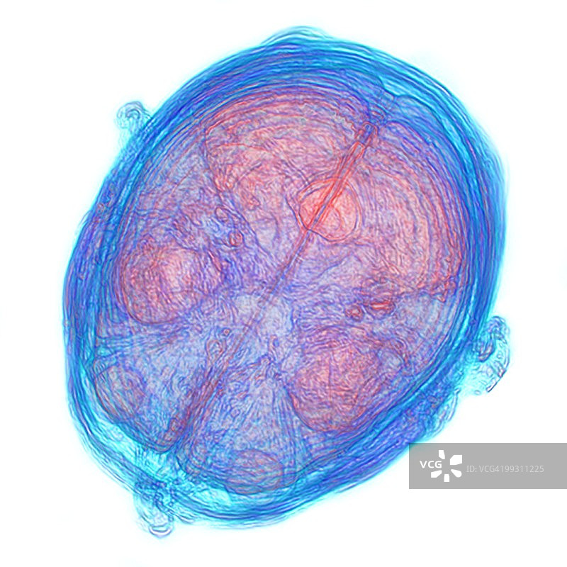 人脑3D核磁共振扫描图片素材