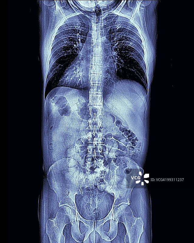 人体躯干MRI扫描图片素材