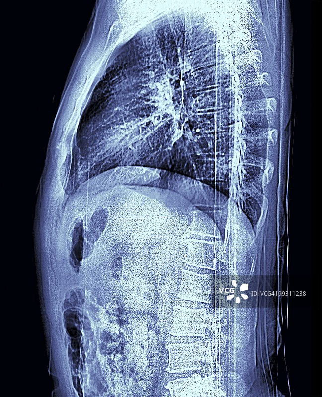 人体躯干MRI扫描图片素材