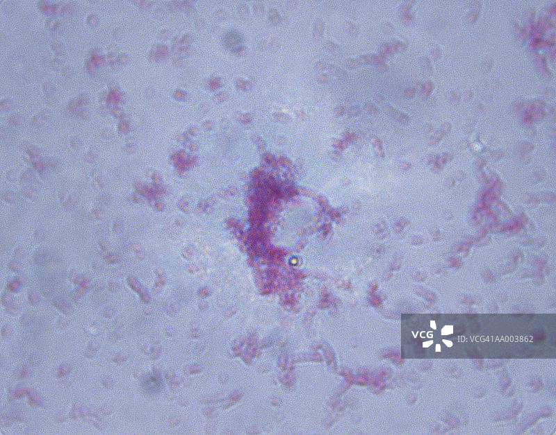 伤寒沙门氏菌的显微图像图片素材
