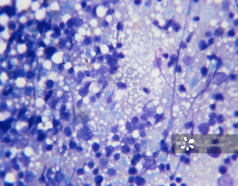 骨髓细胞分裂的显微图像图片素材