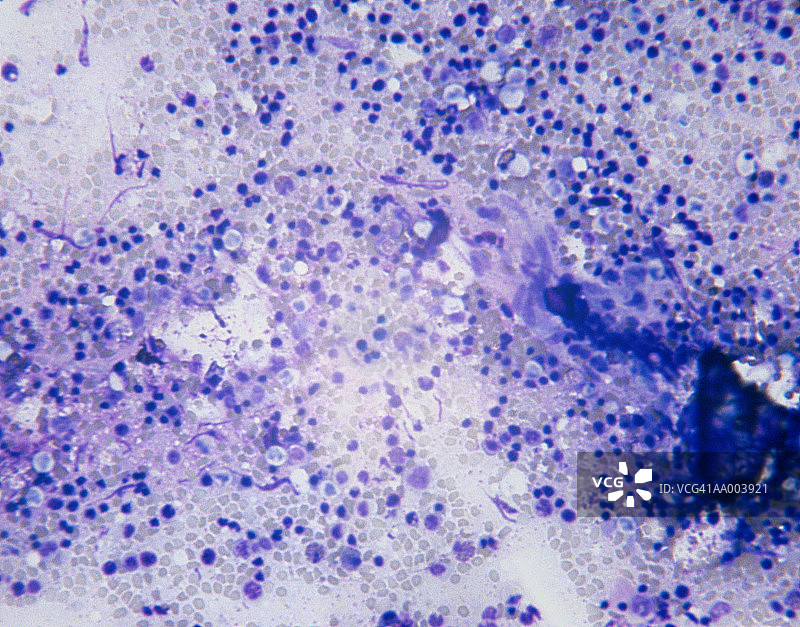 红骨髓的显微图像图片素材