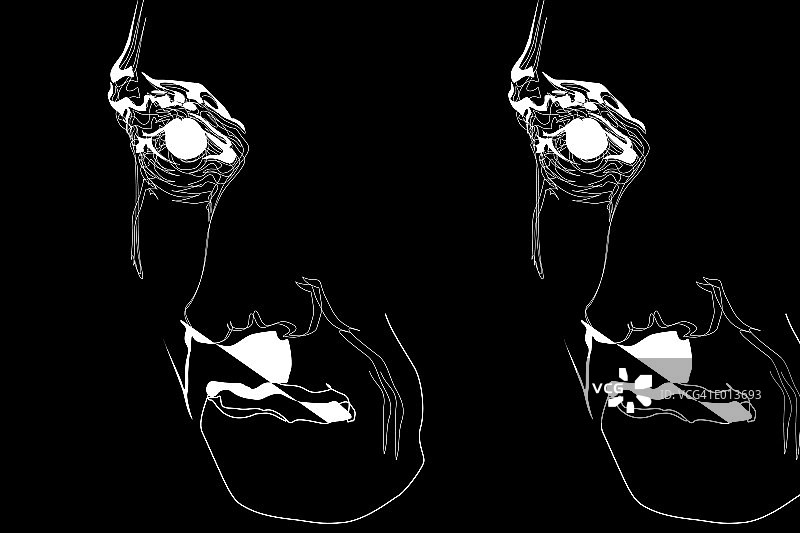 黑色背景上的抽象面孔速写图片素材