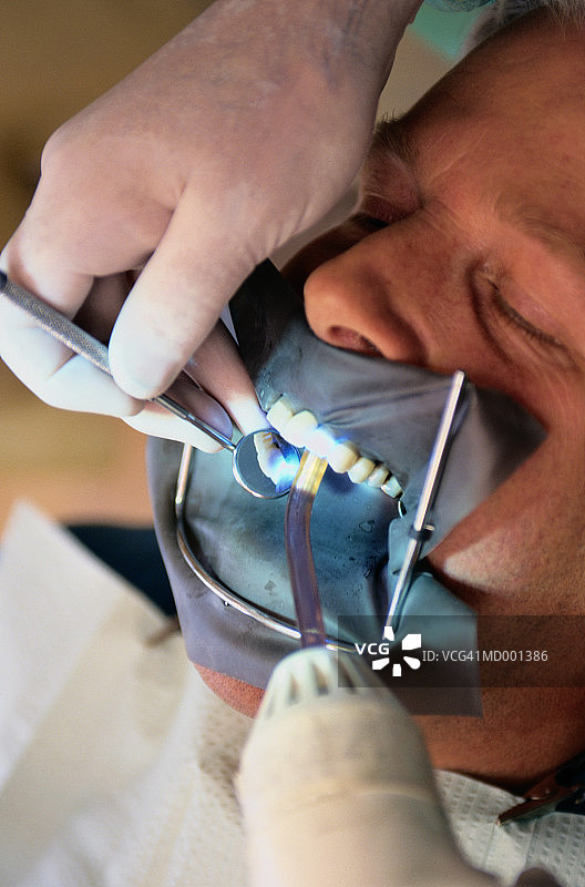 牙齿清洁特写图片素材