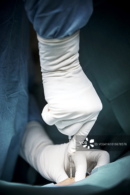 外科医生使用抽吸针提取骨髓图片素材