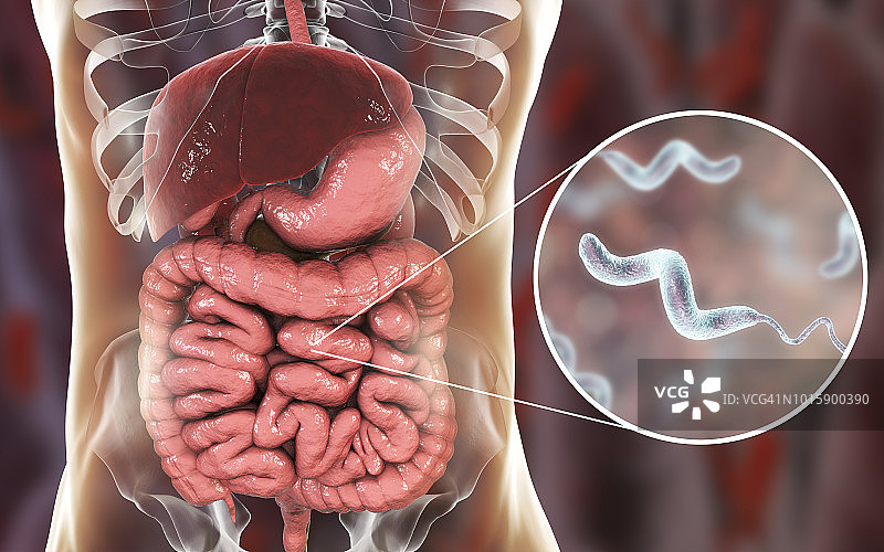 弯曲杆菌病概念图图片素材