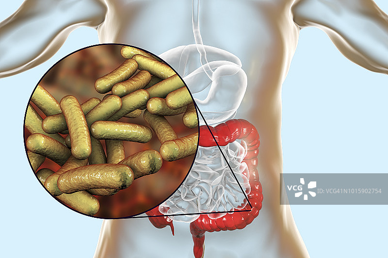 志贺菌病，图示图片素材