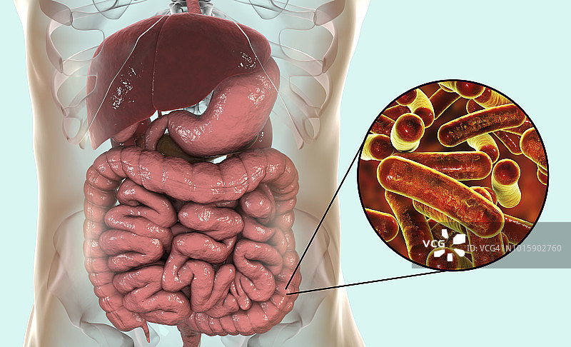 志贺菌病，图示图片素材