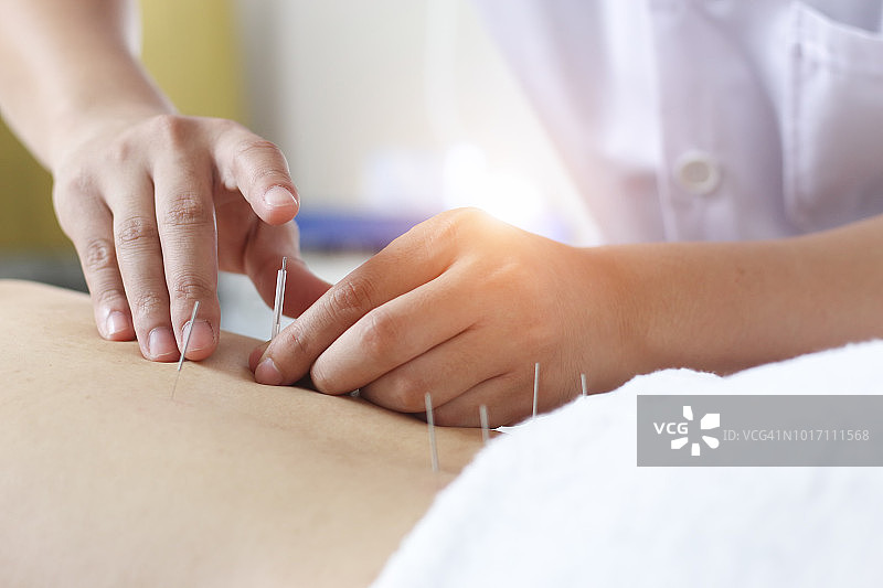传统中医针灸疗法图片素材