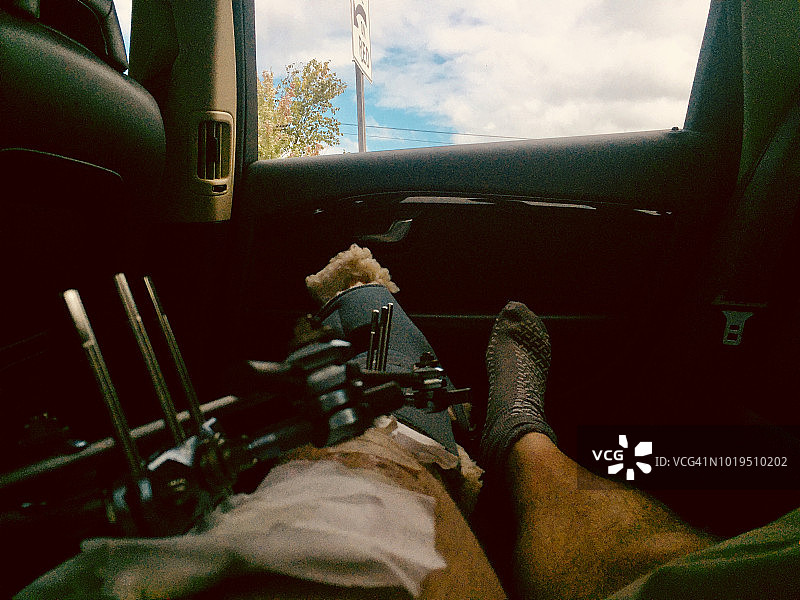 车后座上男人腿部的外固定器图片素材