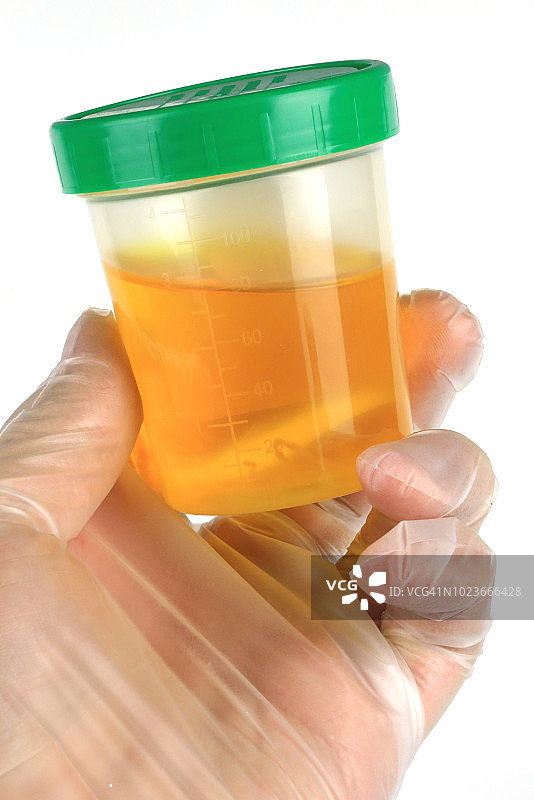 用于测试的密封尿液容器图片素材