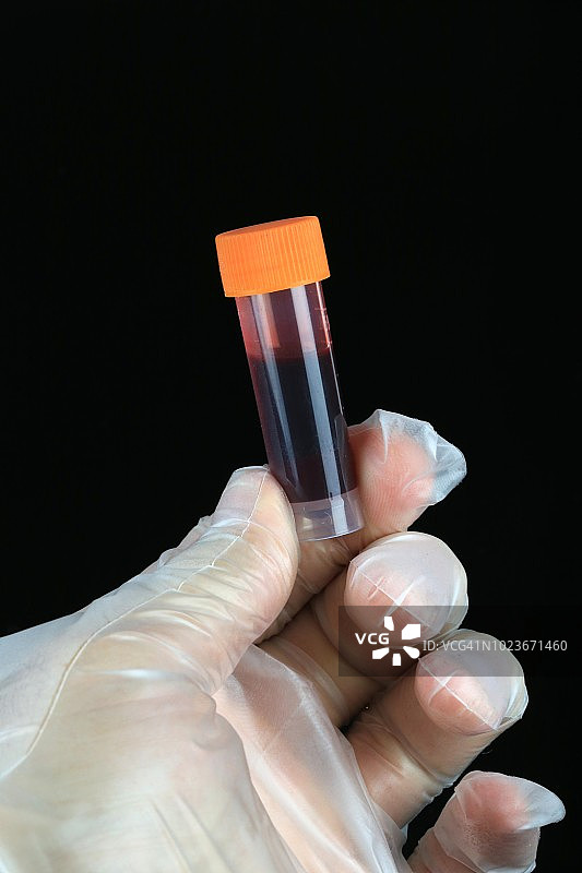 医疗实验技术员检测血液样本图片素材