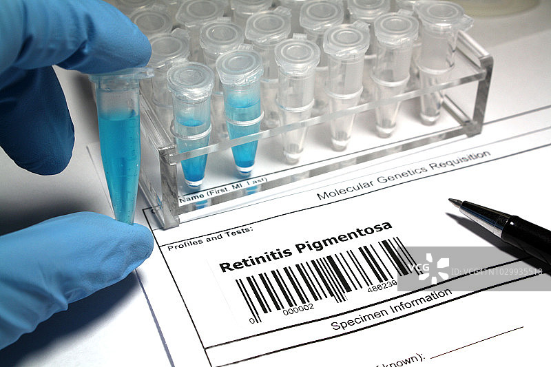 色素性视网膜炎研究图片素材