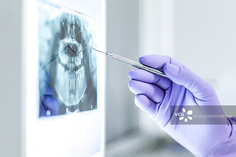 牙科诊所图片素材