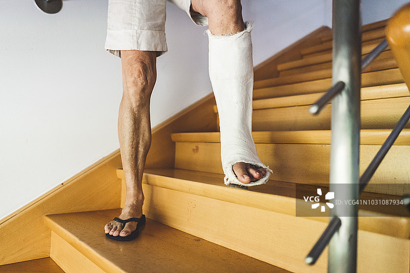 我的腿很疼图片素材