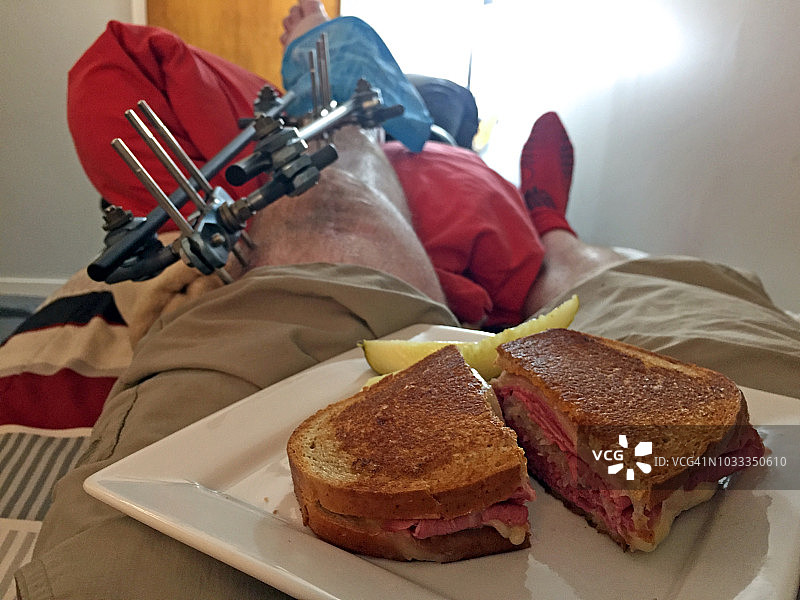 吃熏牛肉三明治，同时冰敷并抬高用外固定器固定的胫骨骨折的断腿图片素材