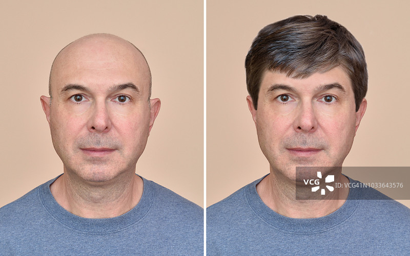 有头发和没头发的男子图片素材