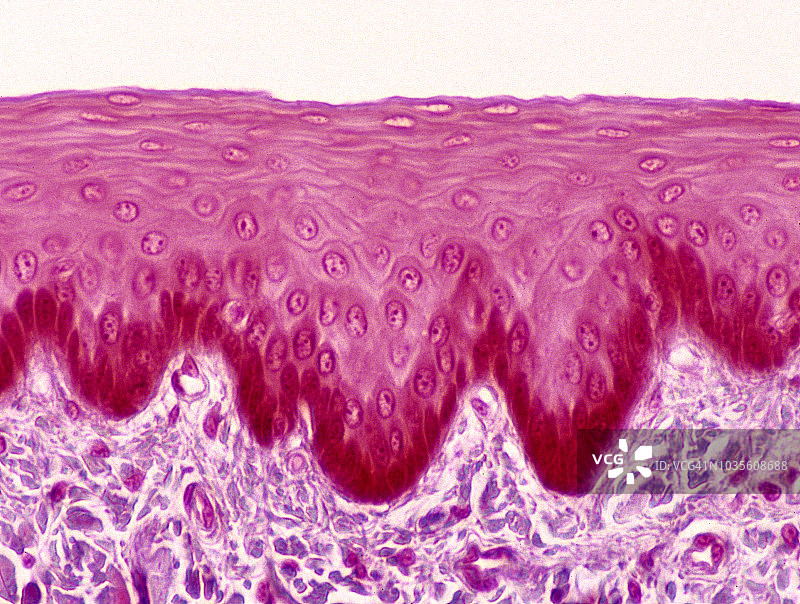 食道鳞状复层上皮（100倍放大）图片素材