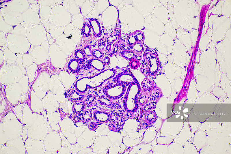 人脂肪瘤显微照片图片素材