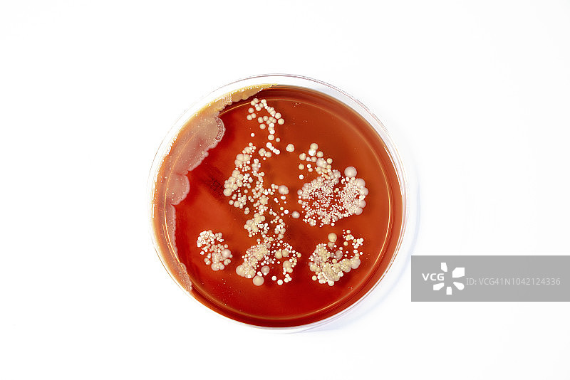 在琼脂培养皿上生长的微生物图片素材