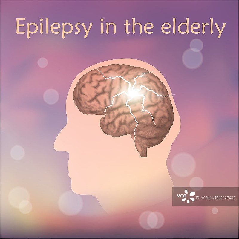 老年人癫痫，图示图片素材