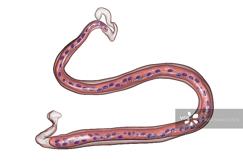 罗阿丝虫寄生虫插图图片素材