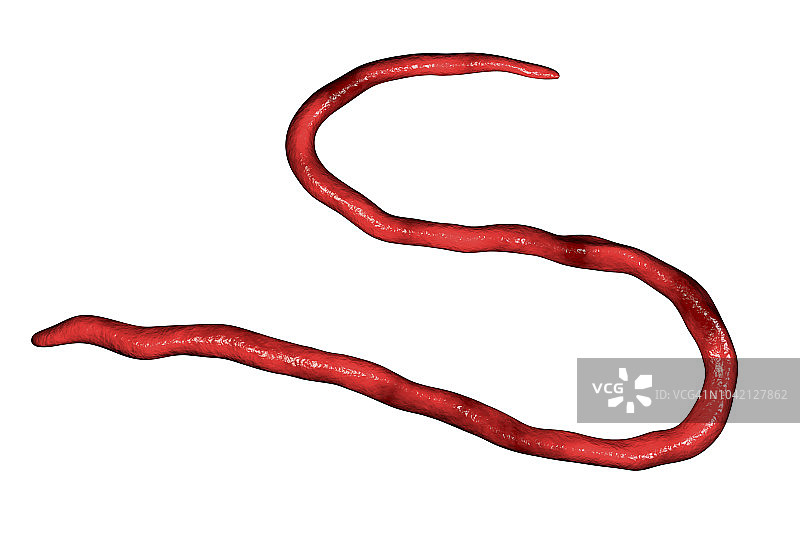 旋盘尾丝虫寄生虫插图图片素材