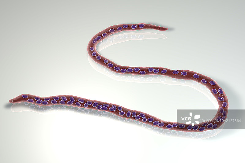 旋盘尾丝虫寄生虫插图图片素材