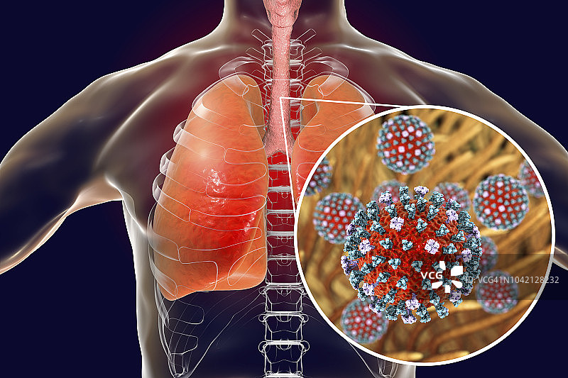 气管中的流感病毒图片素材