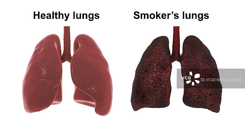 健康肺部与吸烟者肺部对比图图片素材