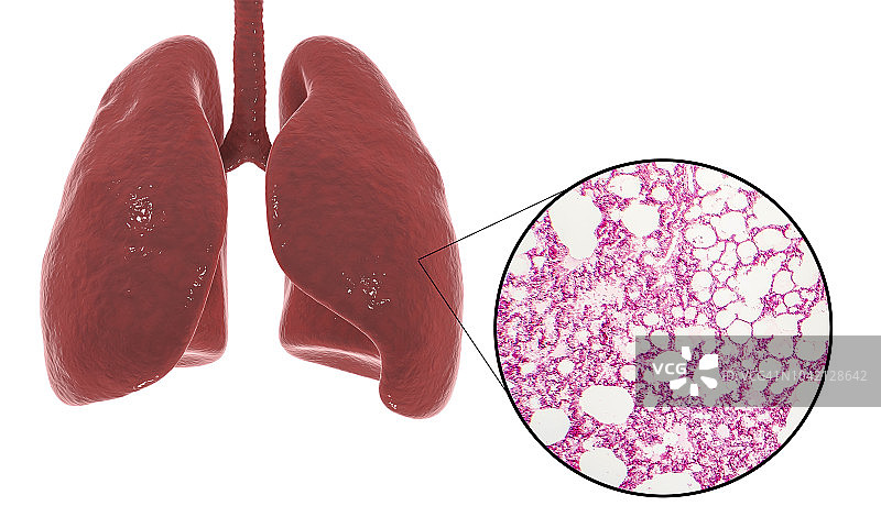 人体肺部解剖与组织学图示图片素材