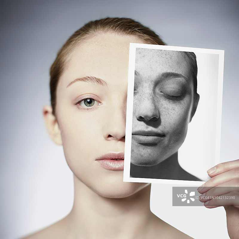 阳光损伤图片素材