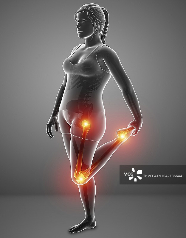 腿痛的女人，插图图片素材