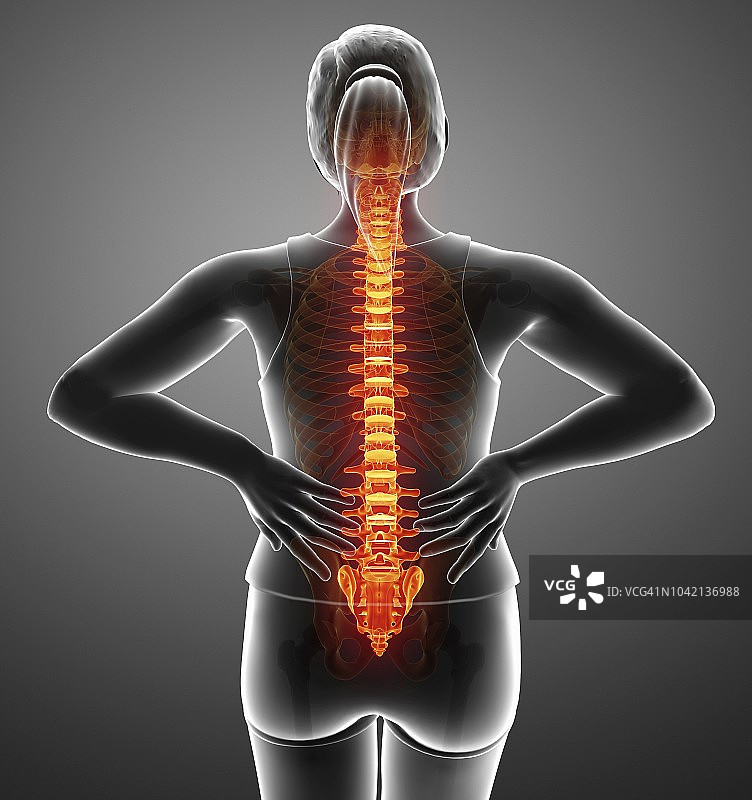 背痛的女人插画图片素材