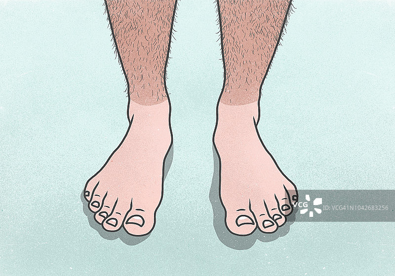 男人晒伤了多毛的腿图片素材