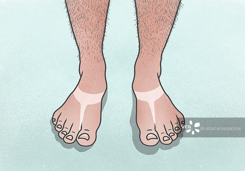 晒伤的男子，人字拖晒痕图片素材