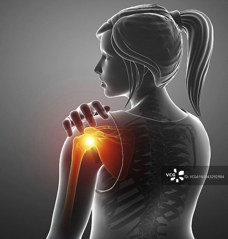 肩部疼痛的女人，插图图片素材