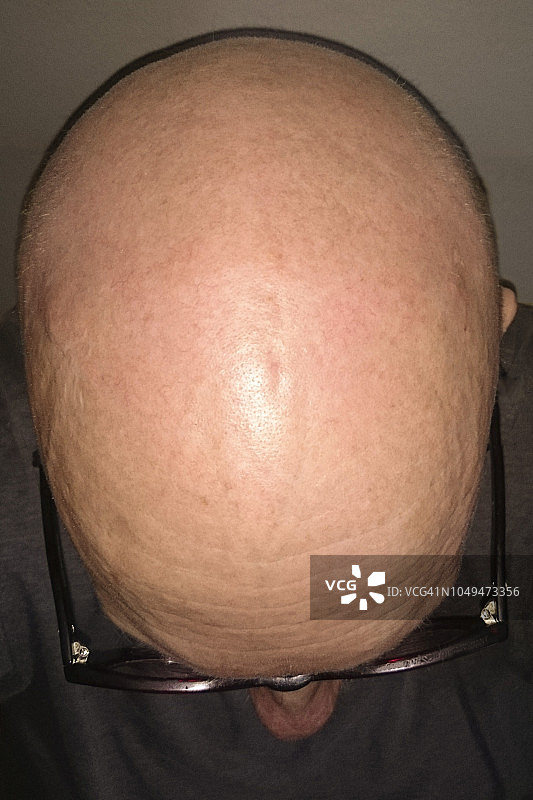 秃顶男人的俯视图图片素材