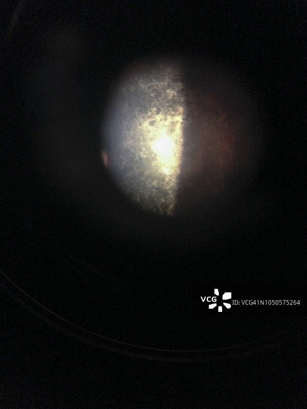 检查视网膜图片素材