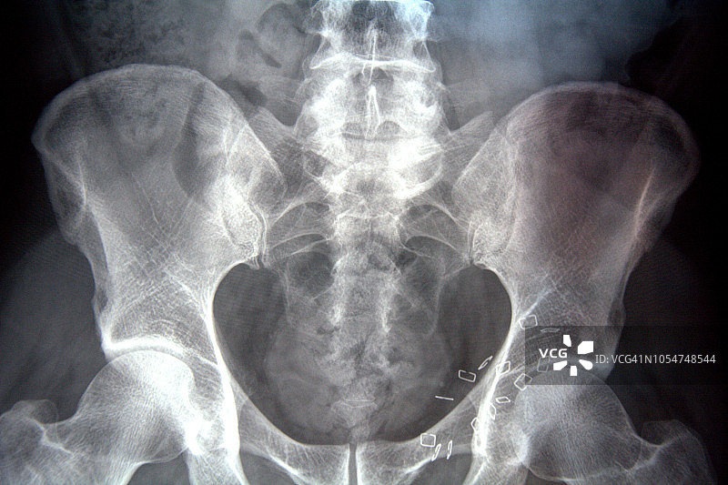 放射线照相图片素材