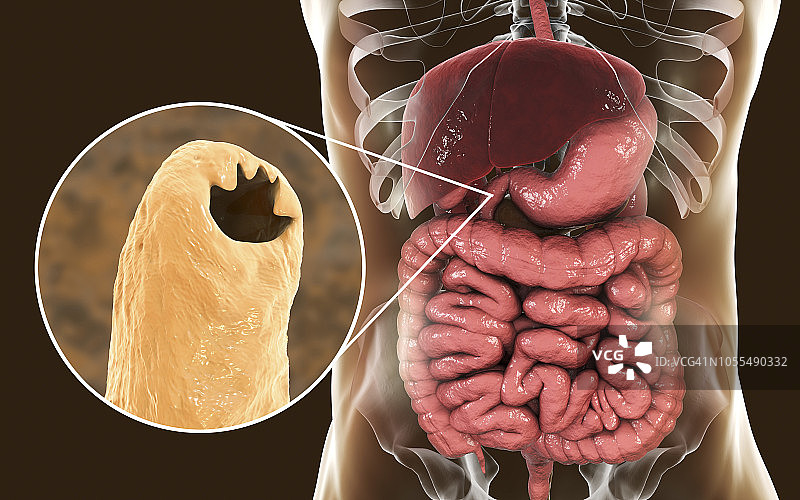 钩虫插图图片素材